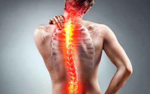 Dores na coluna podem ser causados pela má postura